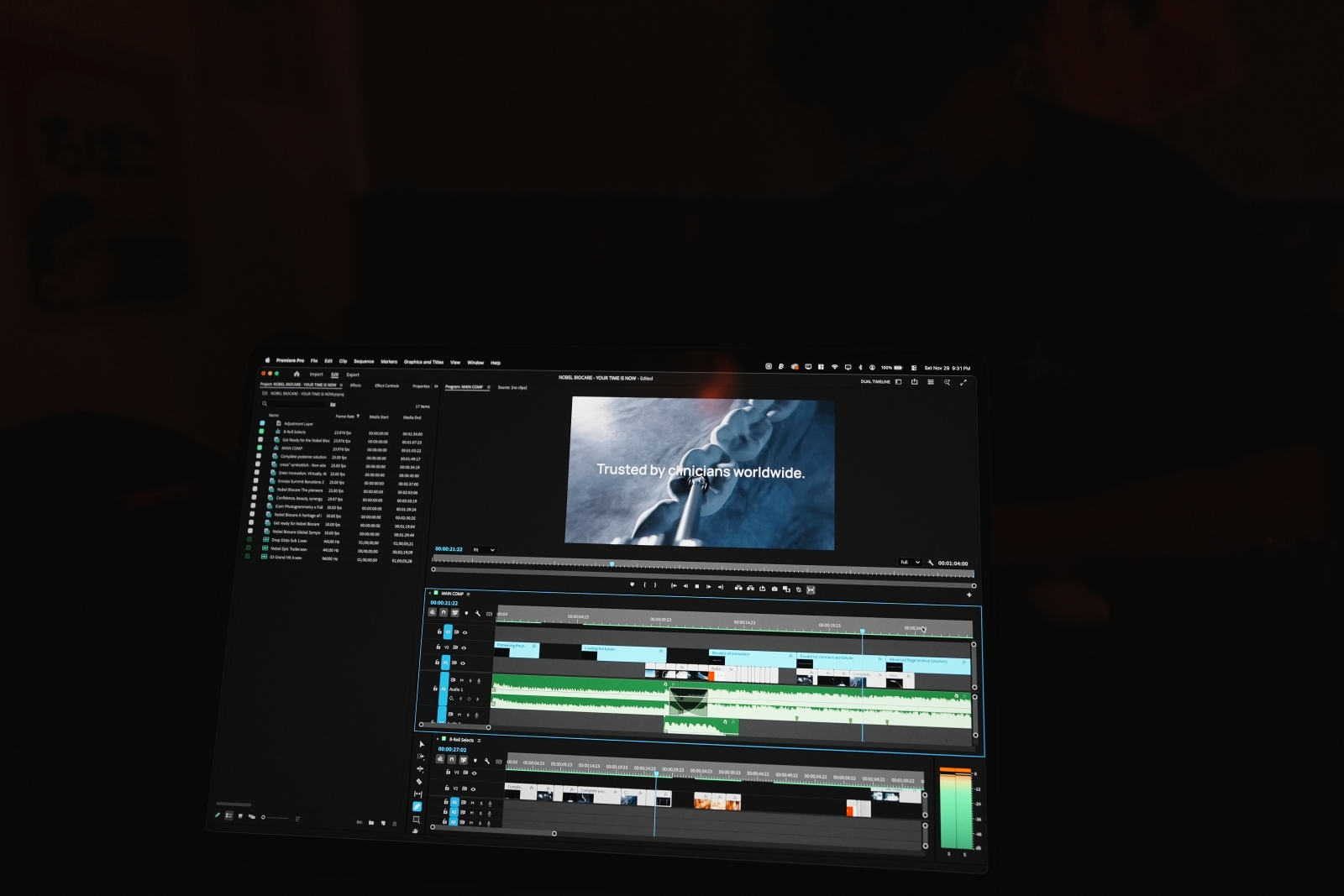 Remote coaching production